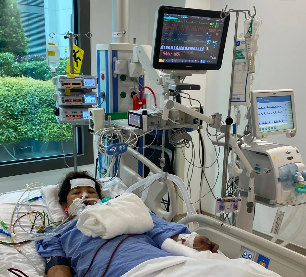 Home Support Life Ventilator (1)